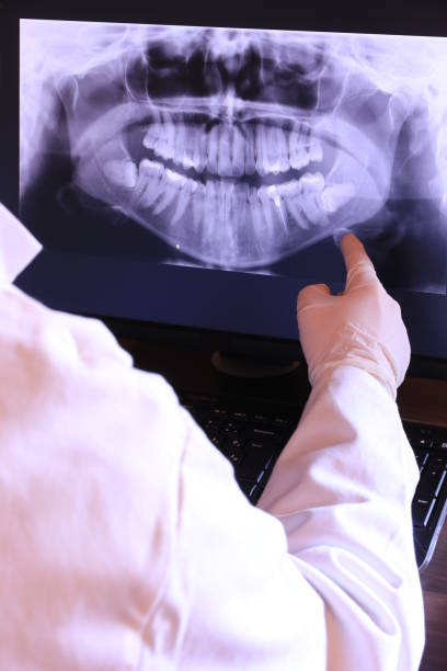 Best Emergency Dentist for Lost Fillings or Crowns in Wartburg, TN